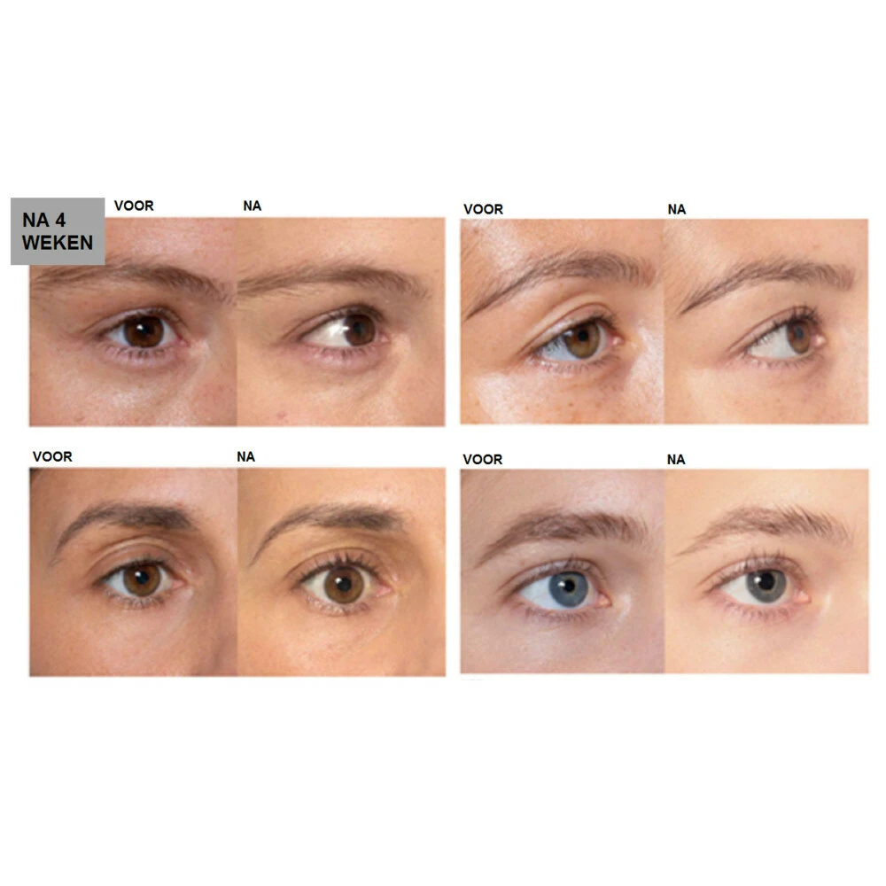 Lu0027Oréal Clinically Proven Wimperserum L'Oreal Lu0027Oréal Clinically Proven Wimperserum -Cosmetica Winkel 994623 4